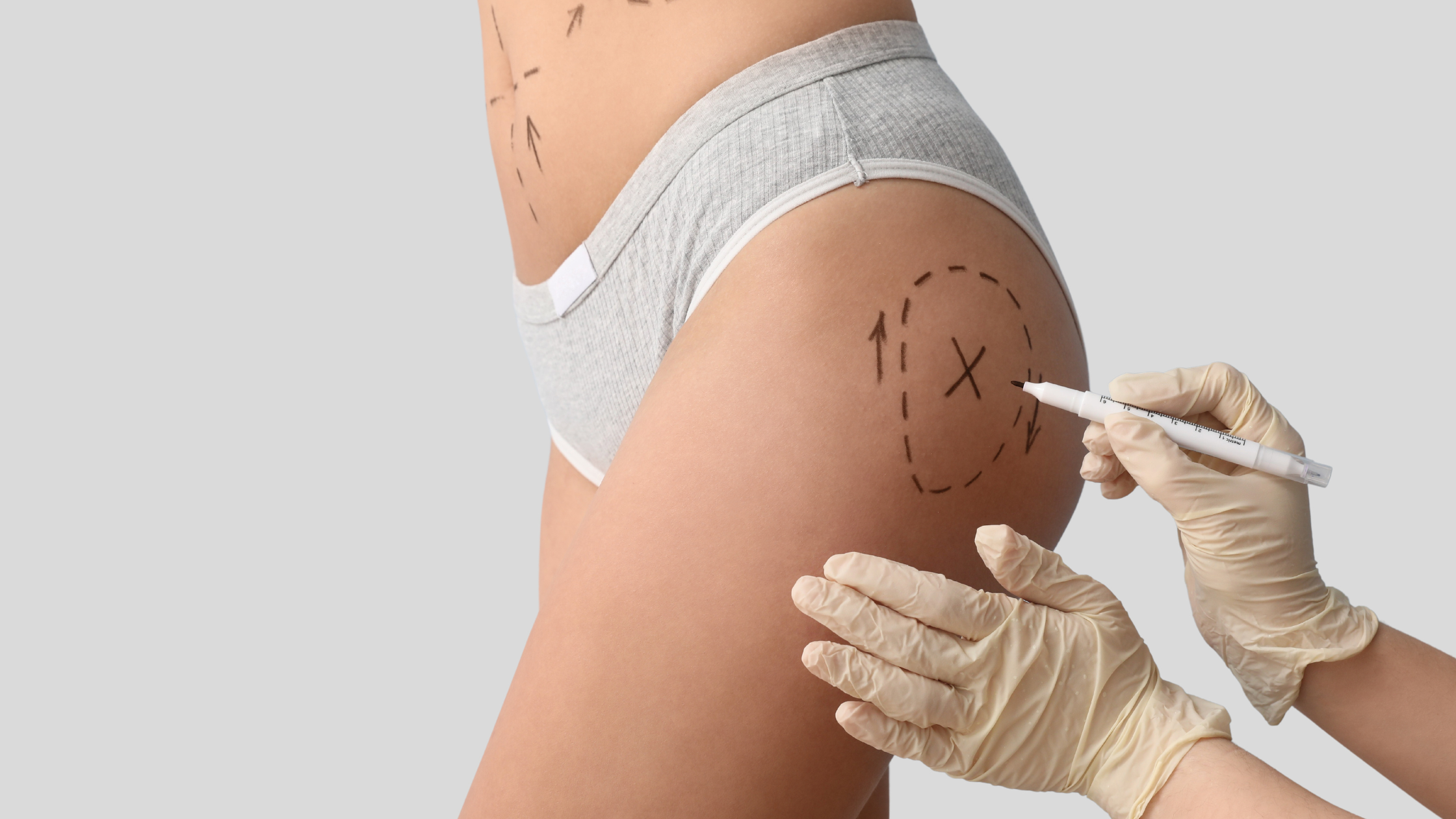 What Happens To BBL After 5 Years?