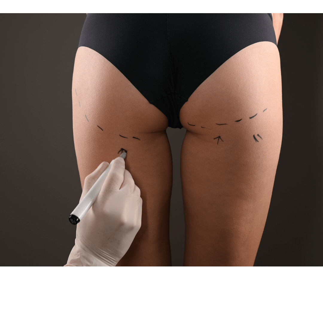 IT IS CRUCIAL TO TAKE PROPER POSTOP CARE AFTER YOUR BBL SURGERY - Bombshell Booty Pillow